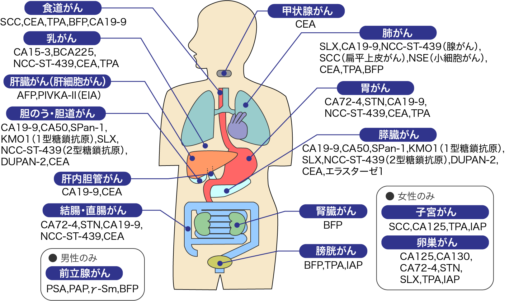 副腎がんとは何ですか?